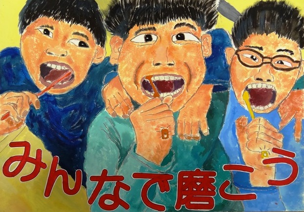 歯 口の健康に関する図画 ポスターコンクール 全国最優秀賞をいただきました Ogawakkoobのページ