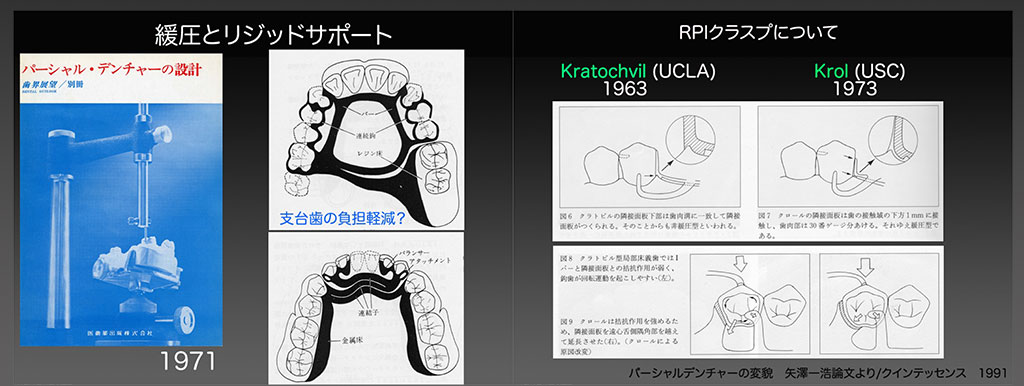 ノンクラスプは嫌いだ〜その3〜_d0148776_19531833.jpg