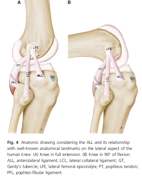 膝に靭帯が新しく見つかった!? - Anterolateral Ligament of the
