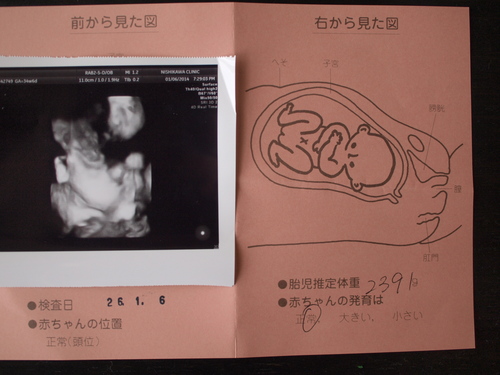 妊娠35週目になりました おくりものはナンニモナイ 2 妊娠35週目になりました おくりものはナンニモナイ 2