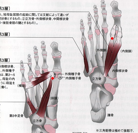 種子骨障害 心療整形外科 種子骨障害 心療整形外科