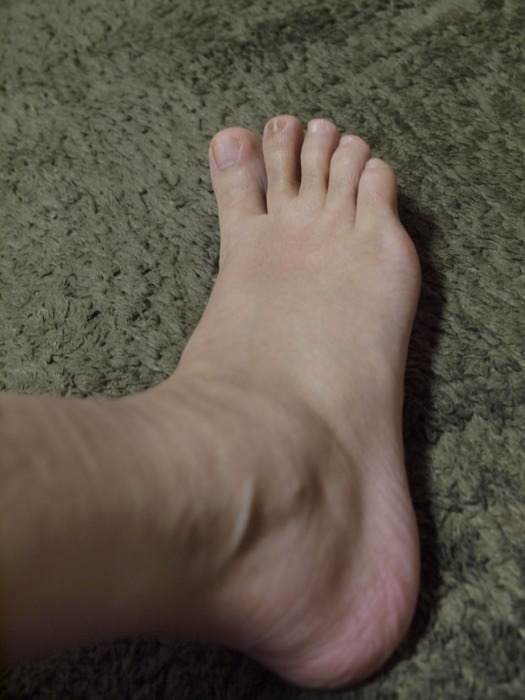 官足法 その後 2_c0116915_0161446.jpg