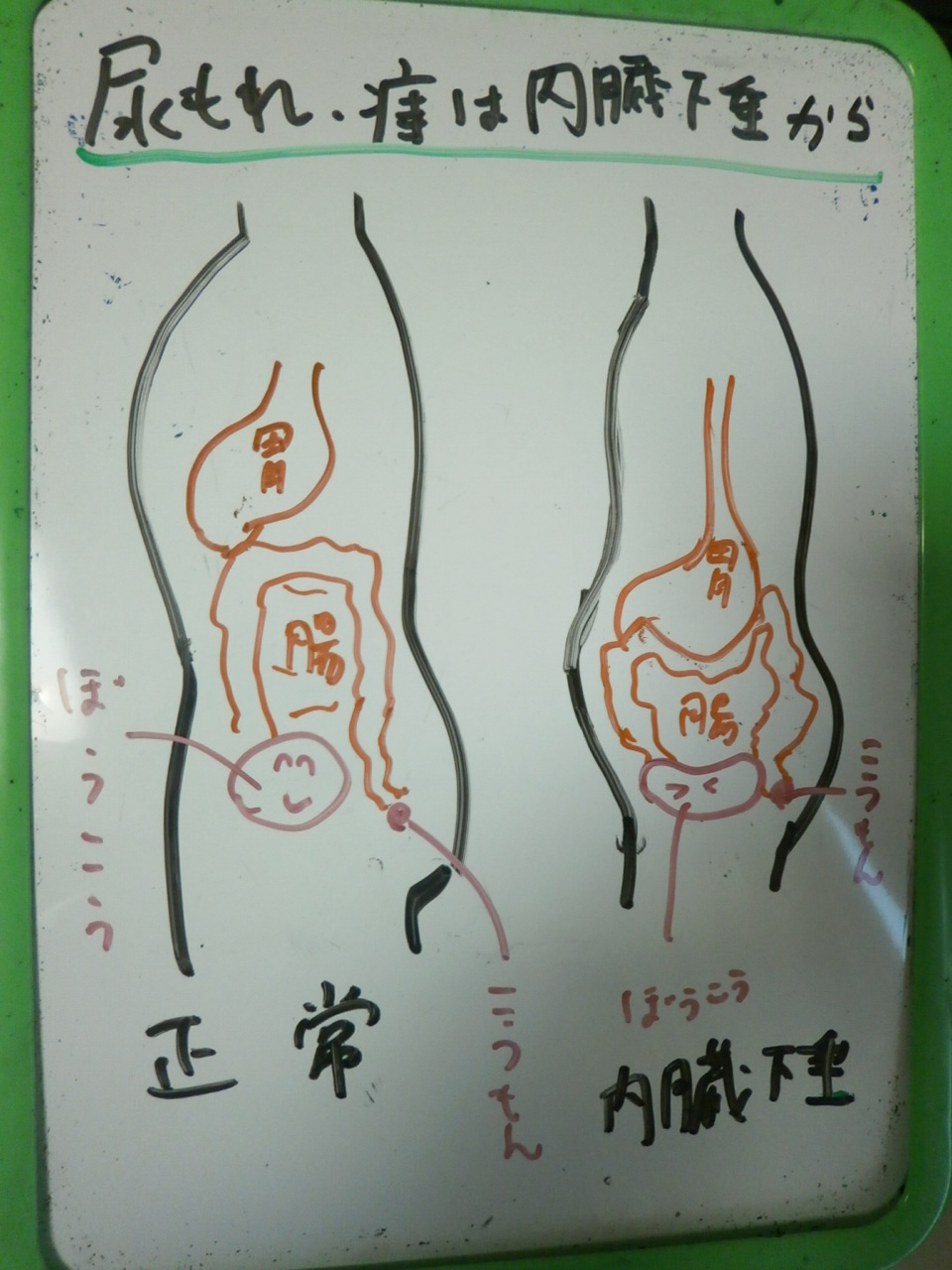 意外とみんな悩んでる 尿漏れ と 痔 の原因は同じ 整体 ツボゲッチューりらく屋 朝霞