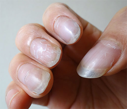 爪のお手入れ (ジェリストを愛用しています)_c0137404_22223755.jpg