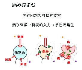 侵害受容性疼痛が神経障害性疼痛となる時 _b0052170_17121324.jpg