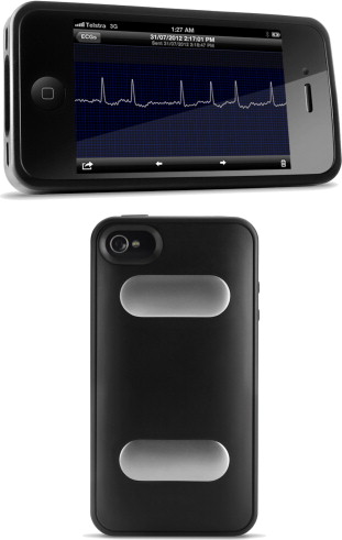 iPhoneで心電図を記録することによる心房細動スクリーニングの有用性と費用対効果：T/H誌_a0119856_2001077.jpg