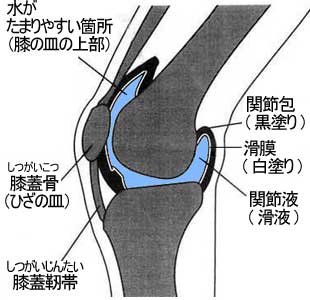 膝手術・入院の総括_f0090954_726240.jpg