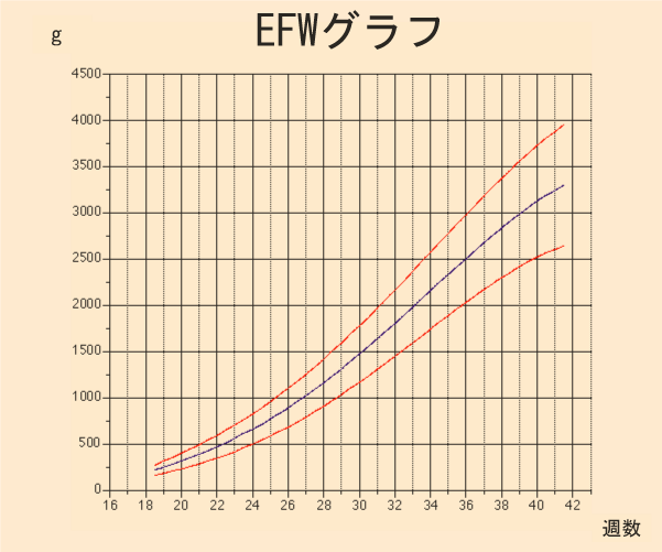 24w3d 妊婦健診 ブドウ糖負荷試験 みんなでお散歩