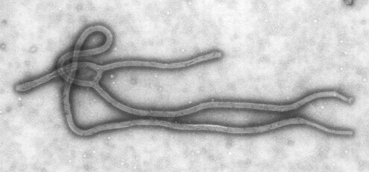 これがエボラウィルスの内部構造だ！：エボラは人造ウィルスか？長すぎますナ！_e0171614_19591898.jpg