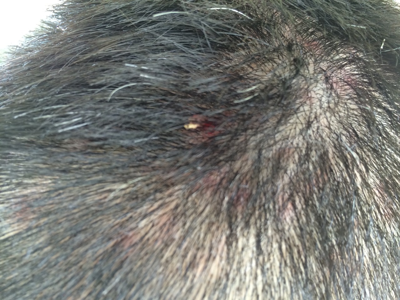 お盆休みでゴルフとまたもや毛嚢炎 : 虚無の帳に包まれて