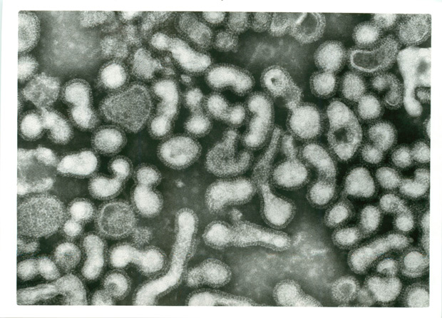 これがエボラウィルスの内部構造だ！：エボラは人造ウィルスか？長すぎますナ！_e0171614_17252077.jpg