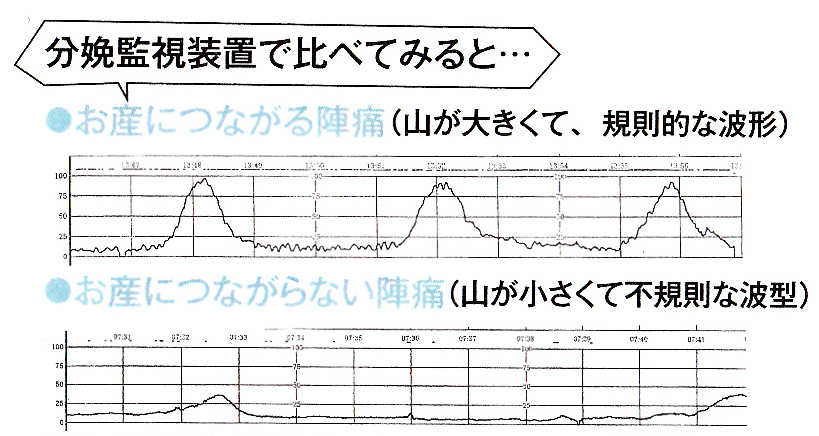 テスト と ストレス は ノン NST(ノンストレステスト)とは？何の為にするの？欠点や料金は？