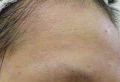 石鹸 シャンプーの選び方 皮膚のアレルギー 札幌の美容皮膚科小笠原クリニック澄川診療所 シミ シワ ニキビ アトピー治療 石鹸 シャンプーの選び方 皮膚のアレルギー 札幌の美容皮膚科小笠原クリニック澄川診療所 シミ シワ ニキビ アトピー治療