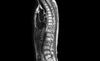 MRI_d0044191_1371637.jpg