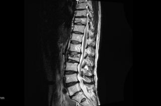 MRI_d0044191_1372957.jpg