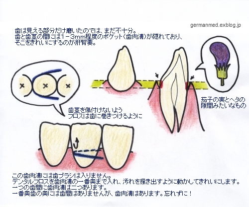 虫歯や歯周病にならない歯の磨き方_d0144726_632986.jpg
