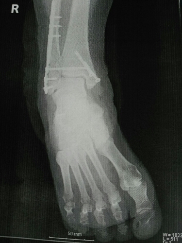 e0047657_11311925.jpg