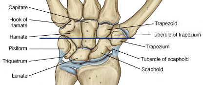 Occult Scaphoid Fracture レントゲン陰性時に次にすべきは さて Innervate The World Occult Scaphoid Fracture レントゲン陰性時に次にすべきは さて Innervate The World