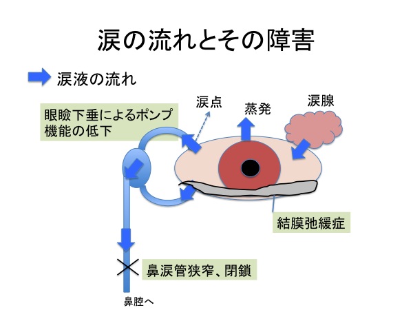 流涙（涙目）について_a0122285_22511820.jpg