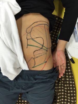 第18回運動器系体表解剖セミナーBコース① 研修会 H26.11.22-23_b0329026_19561816.jpg