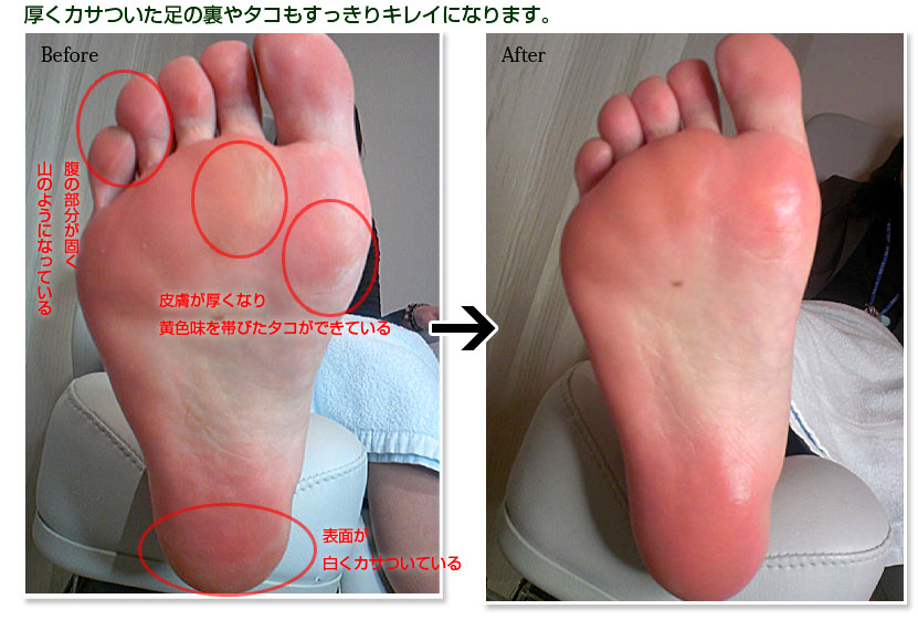 フットケアで足をきれいに フスウントシューカルチャー浅草本店からのお知らせ フットケアで足をきれいに フスウントシューカルチャー浅草本店からのお知らせ