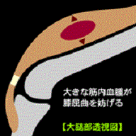 a0099285_16112781.gif