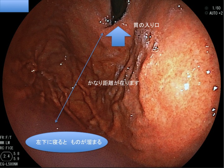 左下にしてますか？_b0180148_5412593.jpg