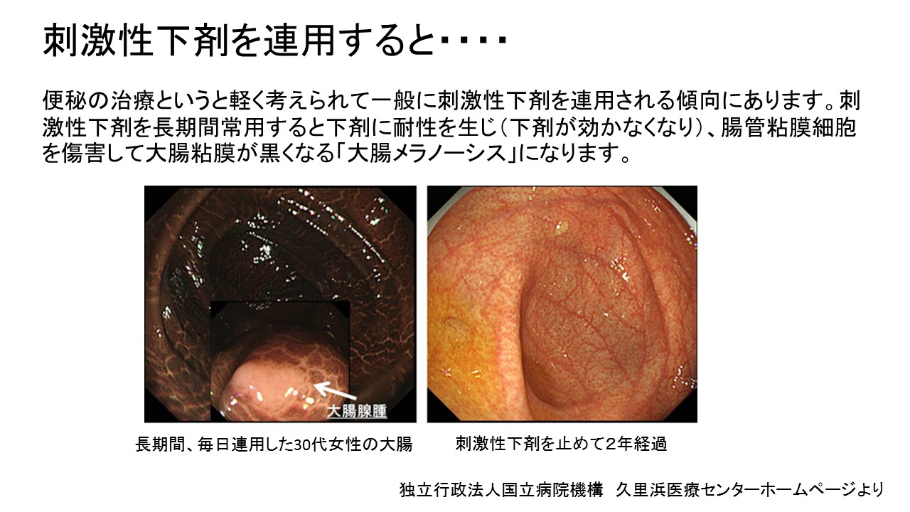 下剤の恐ろしい副作用 クレール日記