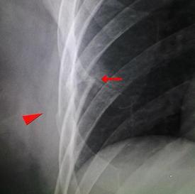 c0179348_15445354.jpg