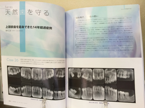 歯科専門雑誌に私の論文が掲載されました_f0154626_165931.jpg