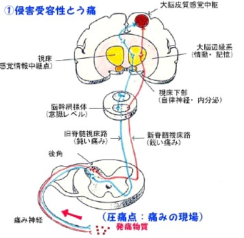 痛みについて医師も患者も知るべき基本的知識_b0052170_16205327.jpg