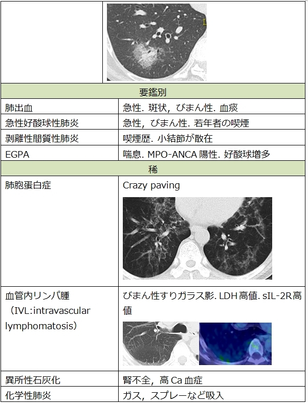 胸部CT　すりガラス影の鑑別_c0367011_14283261.jpg