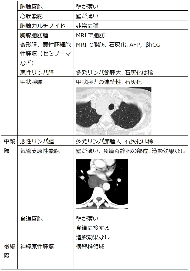 縦隔腫瘍 肺動脈瘤の鑑別 ピクトグラムでわかる呼吸器内科 縦隔腫瘍 肺動脈瘤の鑑別 ピクトグラムでわかる呼吸器内科