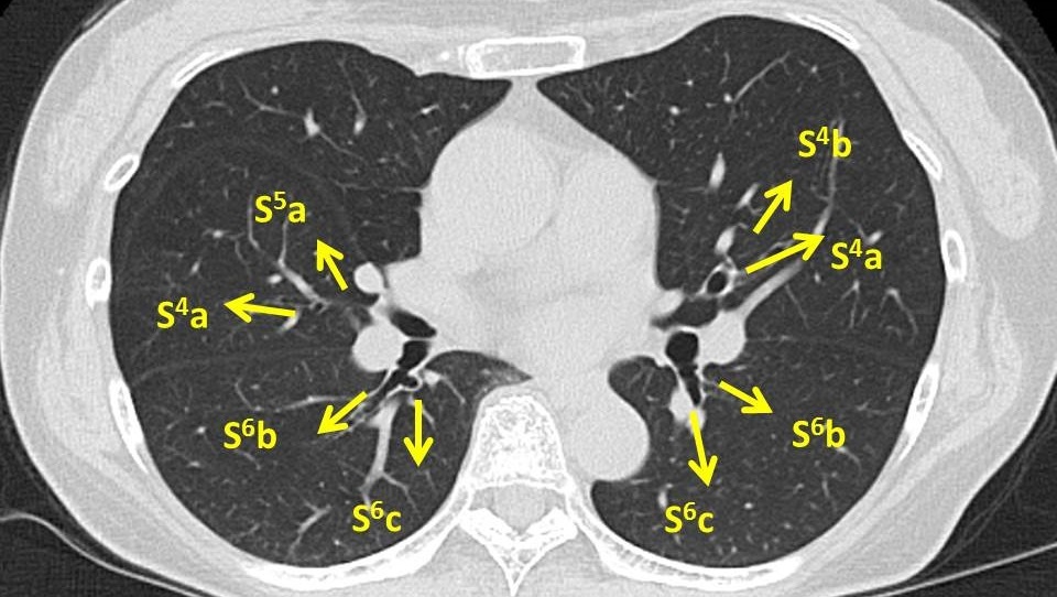 気管支鏡検査bronchoscope 検査前 ピクトグラムでわかる呼吸器内科