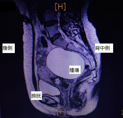 この度、人生初入院初手術。_b0176645_2242132.jpg