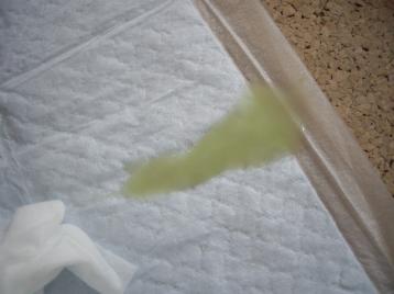 膿のようで気になるので再検査 のんびりソフィ 膿のようで気になるので再検査 のんびりソフィ