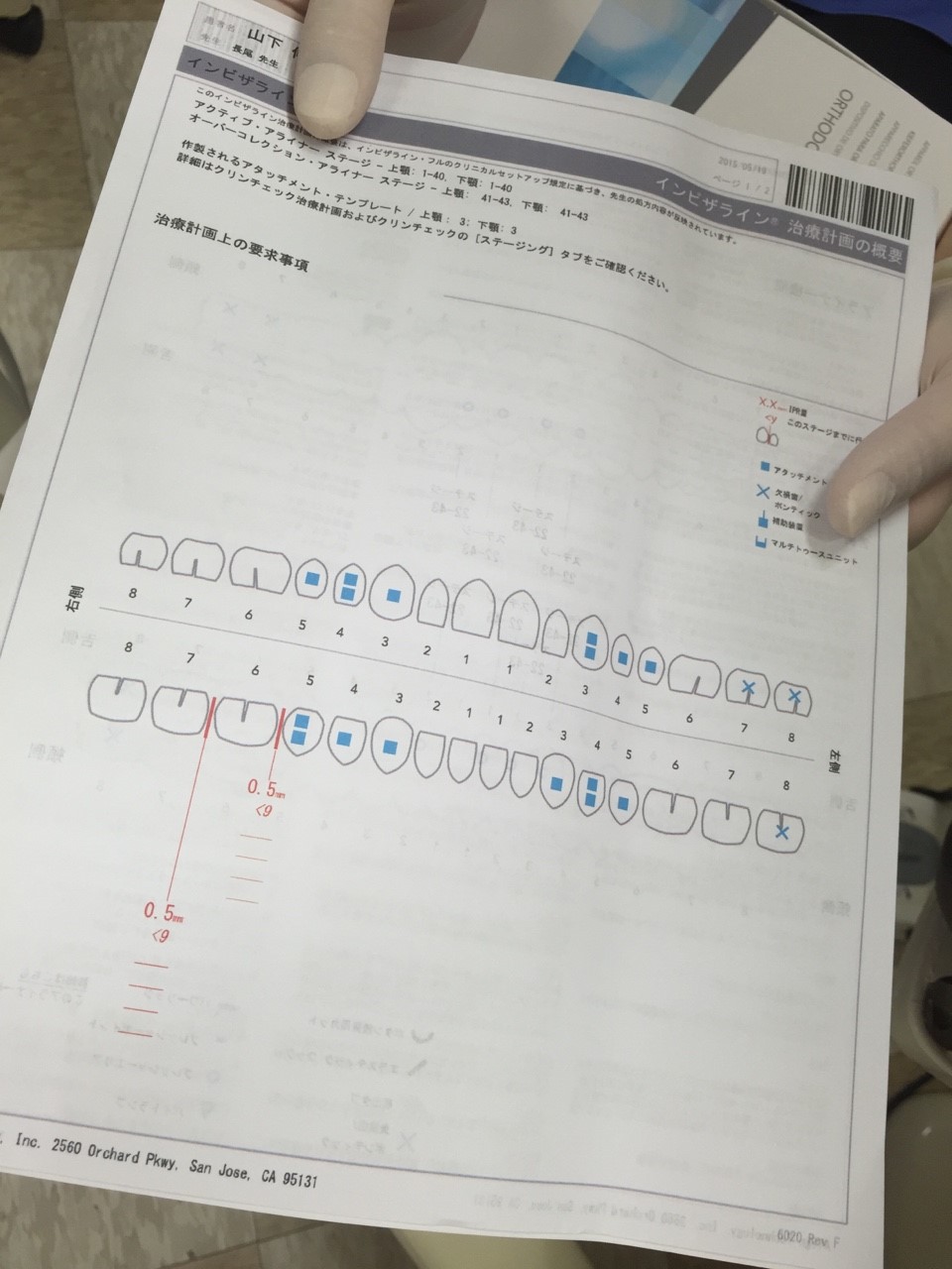 2015/6/5  院長先生、インビザライン矯正始めるの巻き！！_e0336176_13381513.jpg