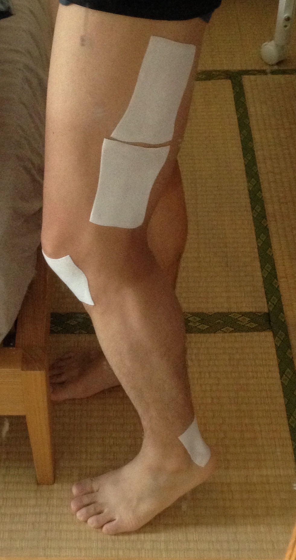 右脚がこんなコトに…_f0310282_21044735.jpg