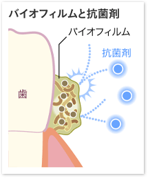 ☆ お気に入りの 歯周病予防ケア  ③アイテム ☆_c0348775_12570758.gif