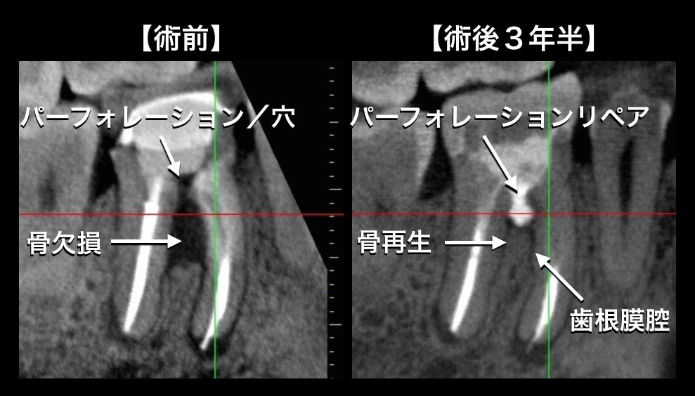 e0004468_06412592.png