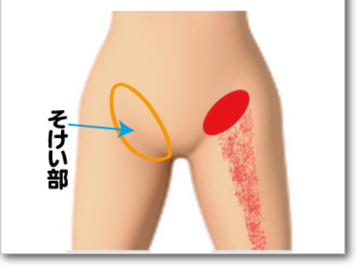 男性不妊_b0328361_00565695.jpg