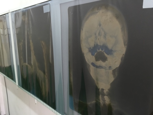 【希少品】倉田式スーパーカイロテクニック　倉田正純 腰痛ならココだ！！ : 月曜日は時々サーフィン・カリアゲクンの