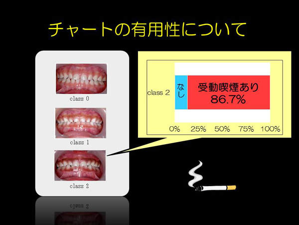 喫煙者は歯周病の自覚症状が無い_f0197703_15501676.jpg