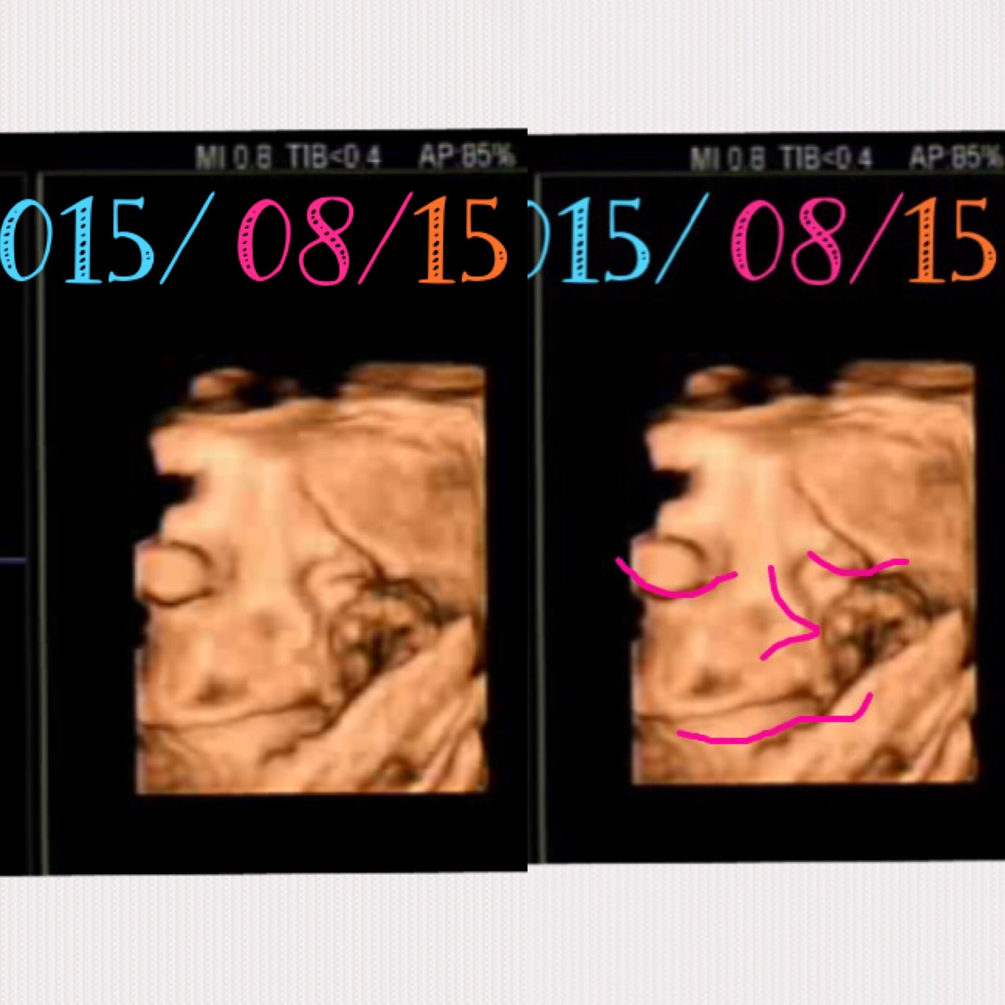 36w 健診&臨月スタート！_b0337752_06351189.jpg