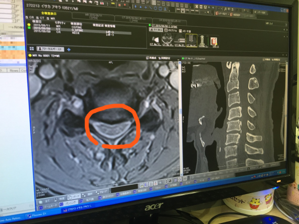 第605回　CT & MRIをとりました〜_b0133822_17394160.jpg