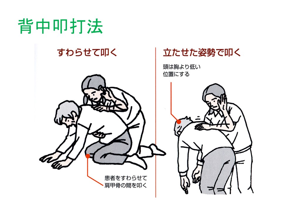窒息対応 ハイムリック法 クレール日記