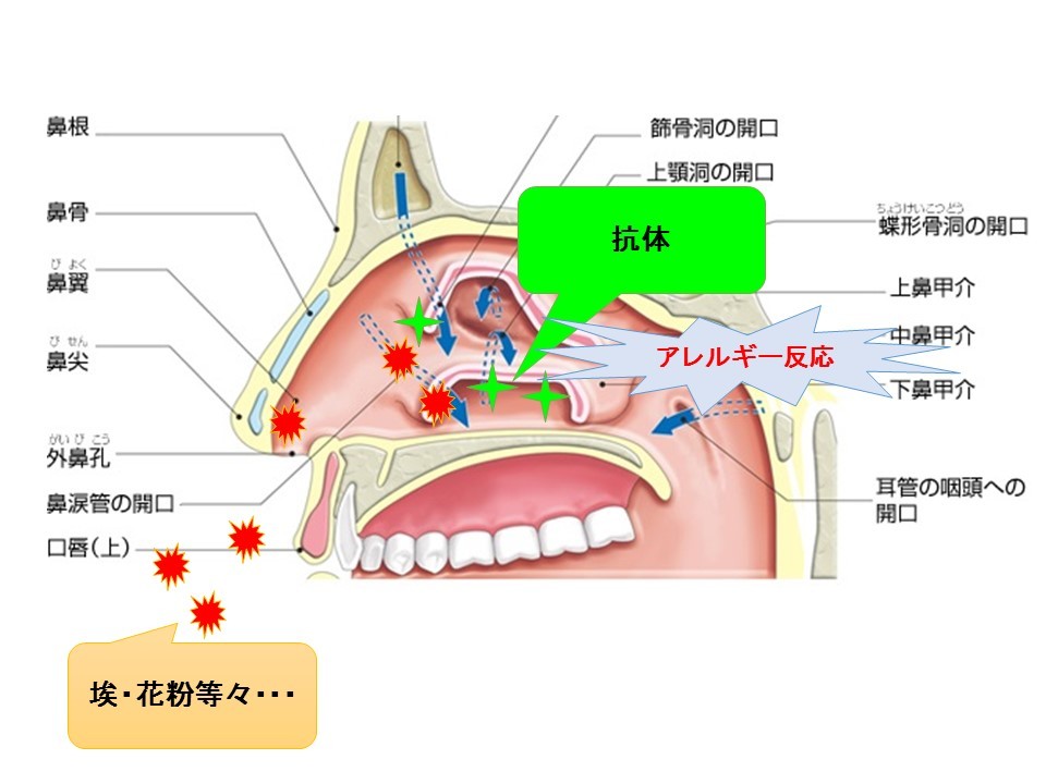 花粉症や鼻炎 季節の変わり目に 鼻うがい がお勧め 老若男女誰でも出来る心身の健康法