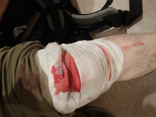 フォールで膝をぶつけ ５針縫う怪我 クライミングメモ139 外31 神戸の岩場3 おなかがすいたら登れない 旧