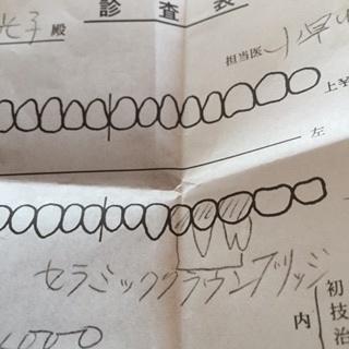 歯のケアーは大切、でもね〜_c0353865_10035591.jpg