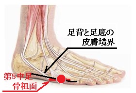 ”いた〜〜い！”話：５６位vs１８３位の戦い、白鵬のねこだまし、死神摩耶！？_e0171614_12585257.jpg